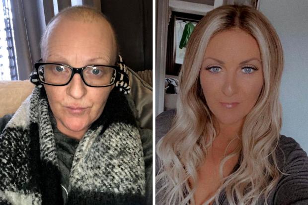 Mandy Thorley, from Bracknell, with and without a wig made by The Wig Studio